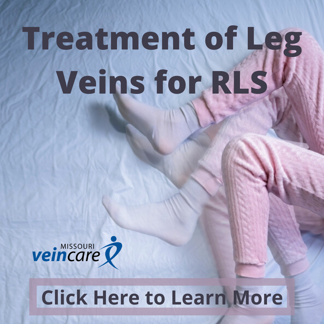 Successful Treatment of Leg Veins for RLS - square
