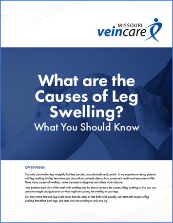 What-You-Should-Know-About-Leg-Swelling-Cover