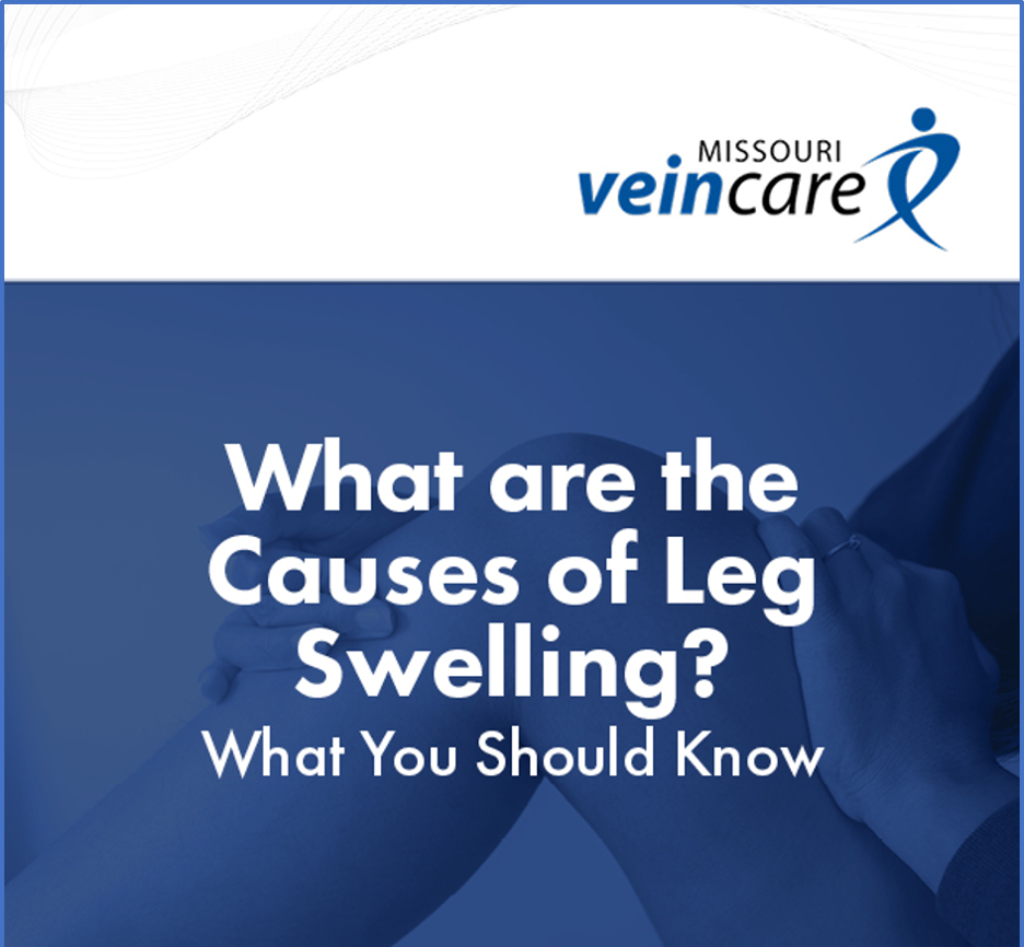 What Are The Causes of Leg Swelling?